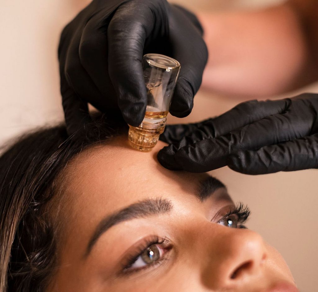 Photo of a woman getting AQUAGOLD treatments