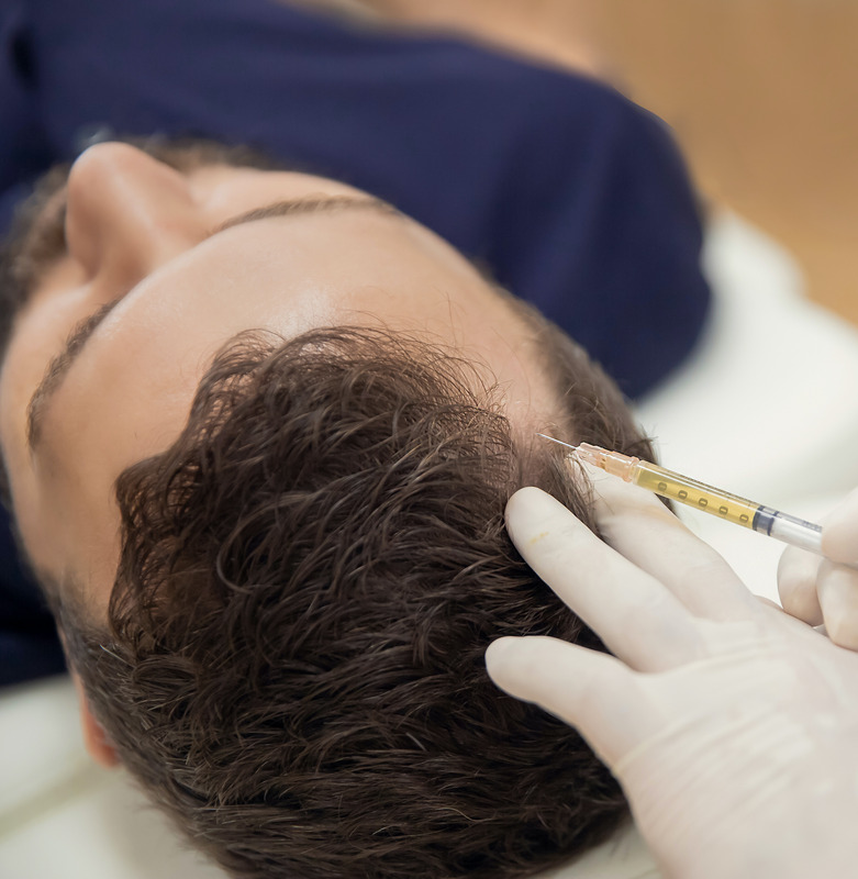 Photo of a man getting hair restoration injections