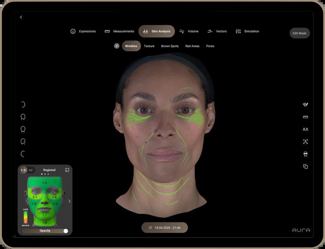 Aura 3D skin scan on an iPad