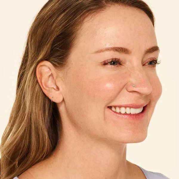 Mandy at full smile 30 days after BOTOX® Cosmetic, with softer crow’s feet lines
