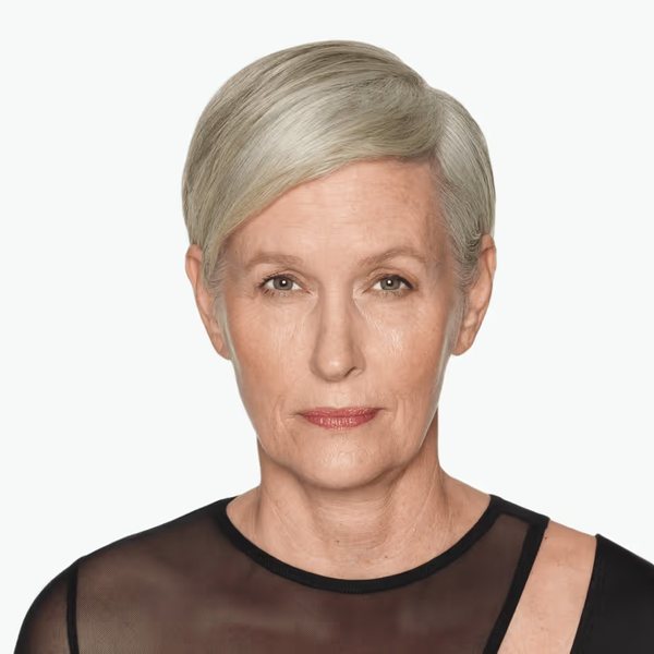 Christine after DAXXIFY®, frown lines