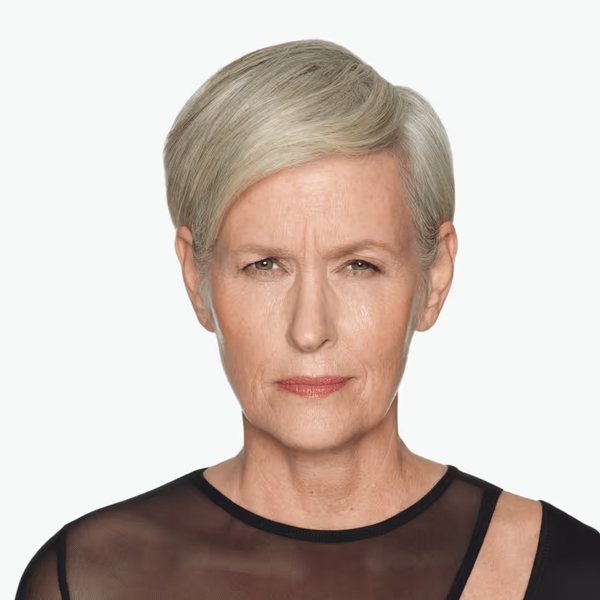 Christine before DAXXIFY®, frown lines