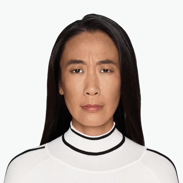 Jiyune before DAXXIFY®, frown lines