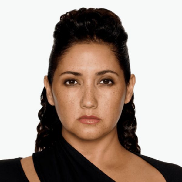 Mariana at maximum frown 6 months after DAXXIFY®, with smoother frown lines