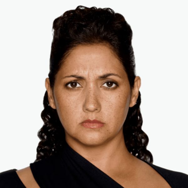 Mariana at maximum frown before DAXXIFY®, showing frown lines between the brows