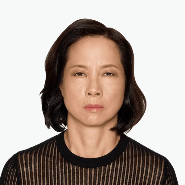 Rosemarie after DAXXIFY®, frown lines