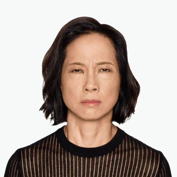 Rosemarie before DAXXIFY®, frown lines
