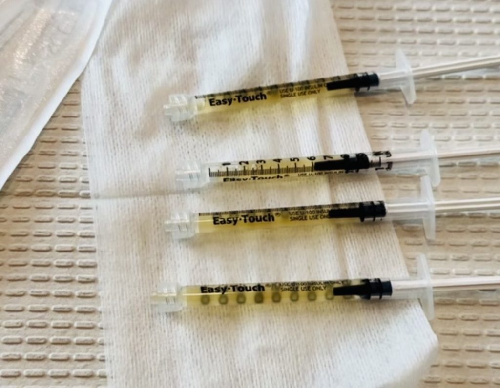 PRP and PRFM gel filler syringes