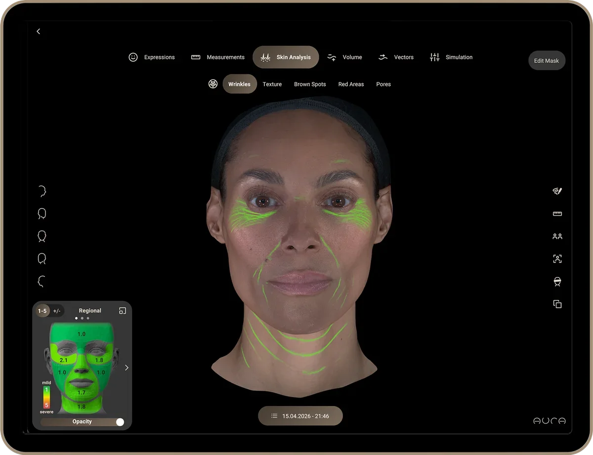 Aura 3D skin analysis on iPad showing wrinkle mapping